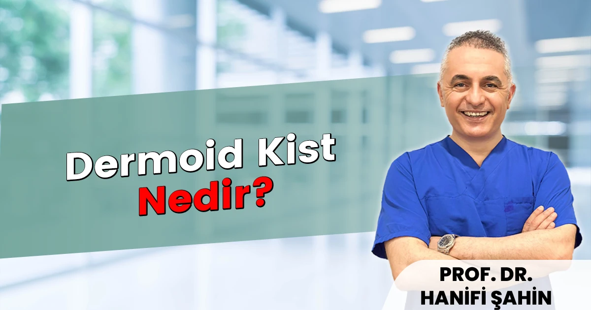Dermoid Kist Nedir?