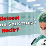 Sistosel Nedir